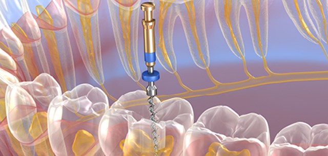 Endodontics image