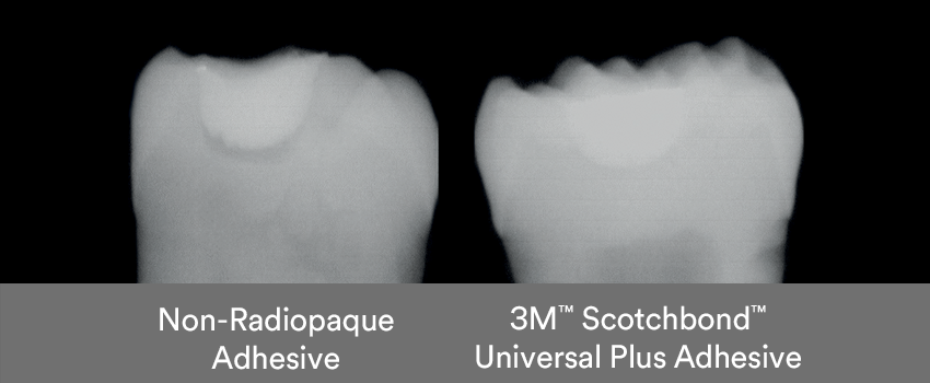 3M_Scotchbond_Universal_Plus_Adhesive_850-x-350.png