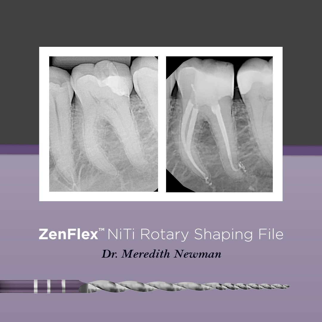 09_ZenFlex-BeforeAfter-DrNewman.jpg