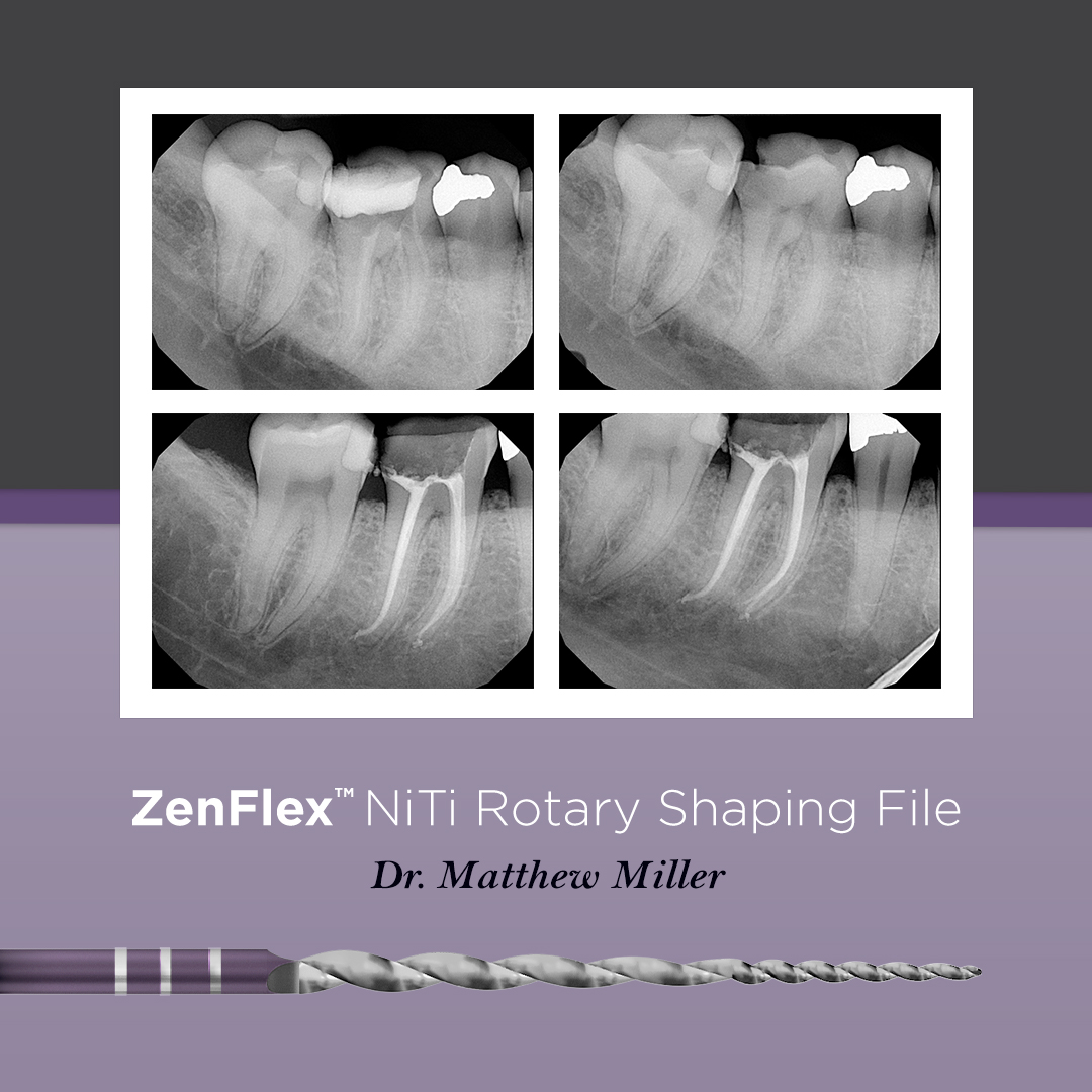 12_ZenFlex-BeforeAfter-DrMiller 2.jpg