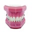 Genius Crystal SLB U5-5 L3-3 Typodont