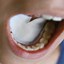 DryDent Sublingual Saliva Control Large