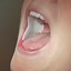 DryDent Parotid Saliva Control Small