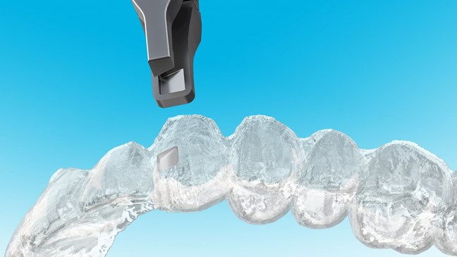 Clear Collection Counter Clockwise Wedge
