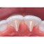 Reliamold Habit Attachment