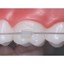 Reliamold Tube Attachment