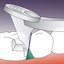 PerForm Proximal Contact Introductory Kit