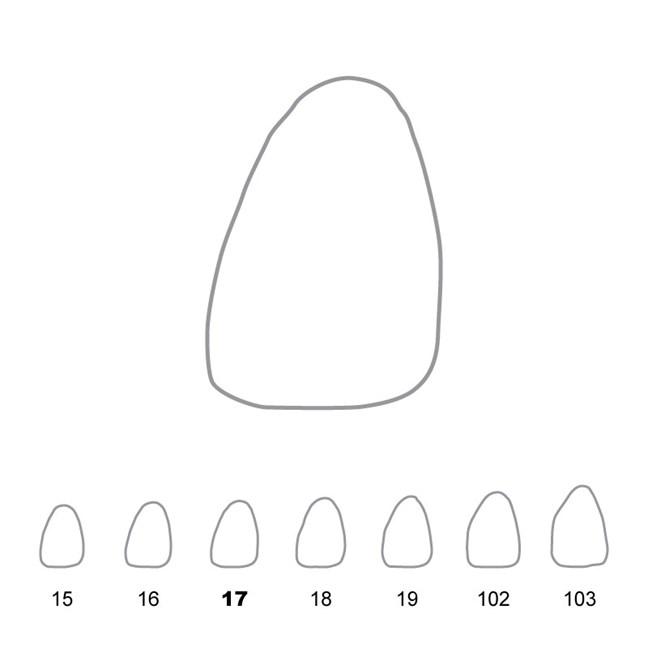 Temporary Crowns Upper Central Incisors Left 17