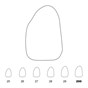 Temporary Crowns Upper Lateral Incisors Left 200